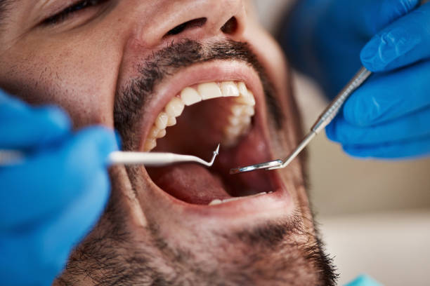 Best Emergency Dental Care for Trauma or Injury in North Spearfish, SD